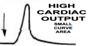 Graph of curve indicating high cardiac output.