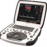 uSmart 3300 Ultrasound System