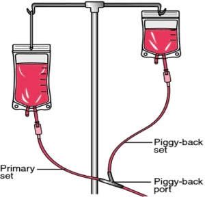 Figure 2. The inverse square law can be used to administer two intravenous solutions through a single-channel IV pump. 